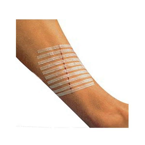 Полоски клейкие Steri-Striptm, 5полос Ml
